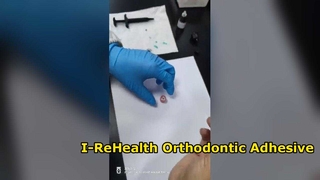 Ortodontik Yapıştırma Sistemi